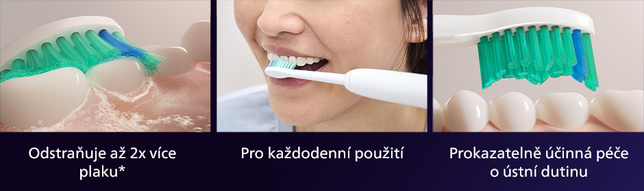 Philips HX6018/87 Sonicare ProResult